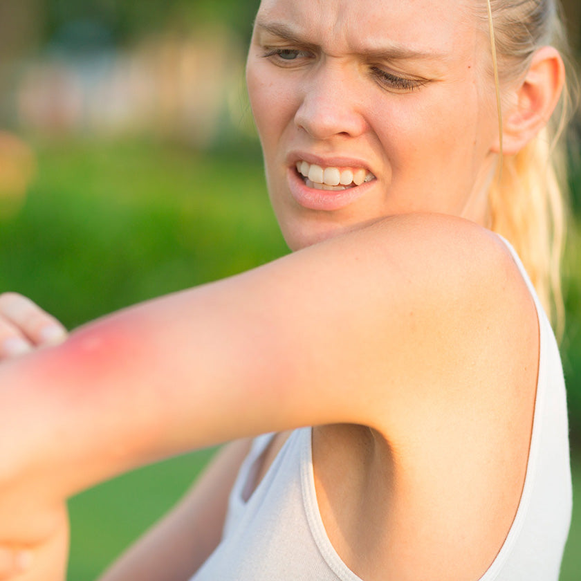 Are you a Mosquito Magnet™?
